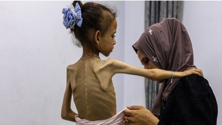 गाजामा सीमित राहत पहुँचले बालबालिकाको पोषण सङ्कट गम्भीर : संयुक्त राष्ट्रसङ्घ